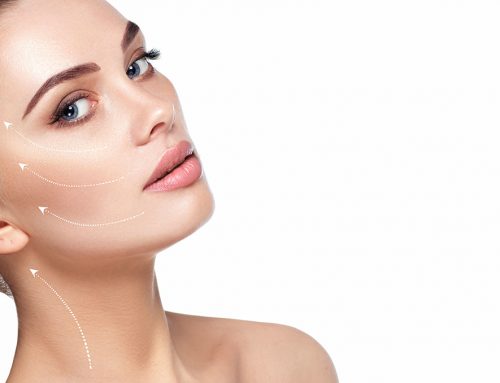 Sculptra: Como este inovador procedimento ajuda a combater a flacidez facial?