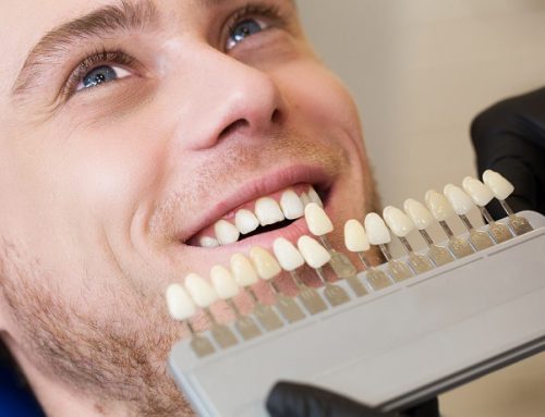Lentes de contato dental: O que são e quais as vantagens?